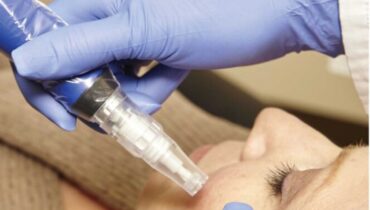 microneedling with prp in brentwood tennessee
