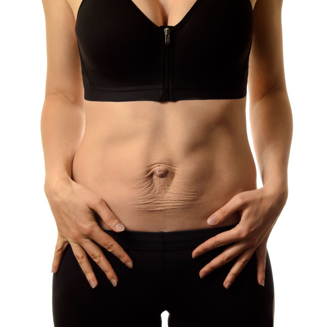 emsculpt for diastasis recti brentwood tn