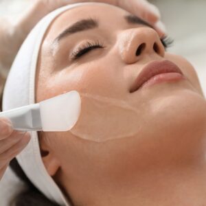 chemical peel nashville tn