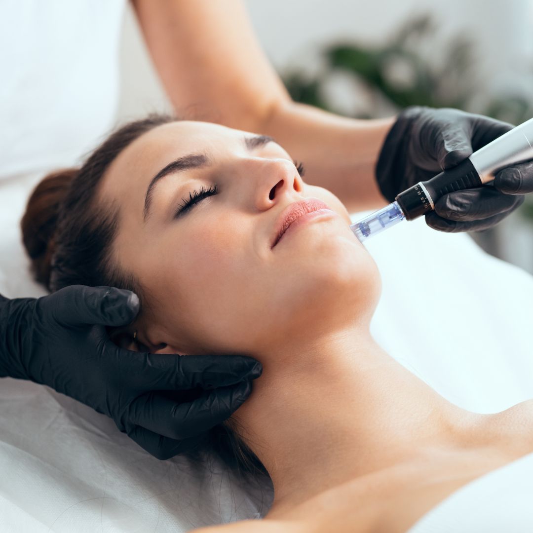Microneedling in cool springs tn