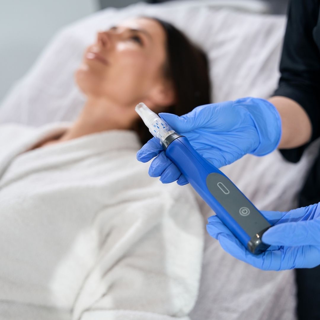 skinpen microneedling franklin tn