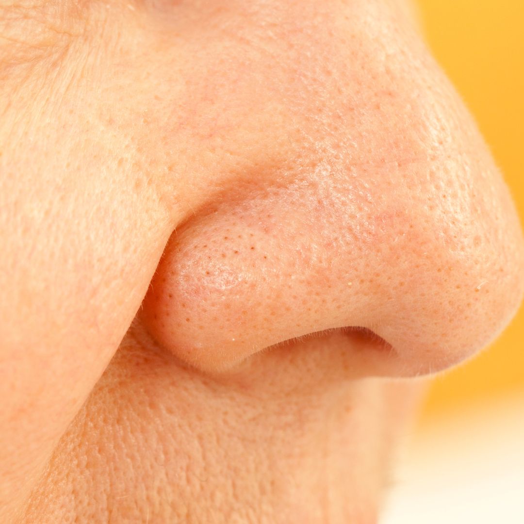 congested skin treatment near brentwood tn