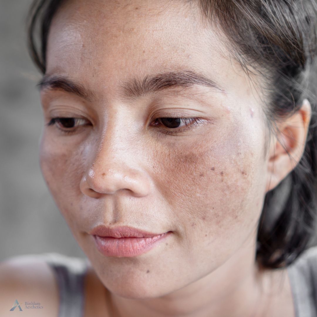 sun damage treatment nashville tn